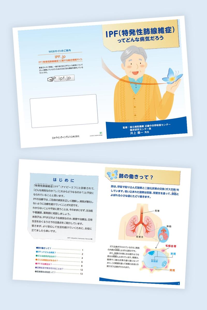 IPF（特発性肺線維症）ってどんな病気だろう