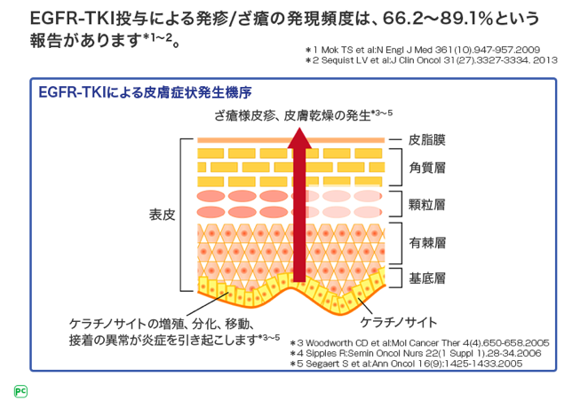 図1 EGFR-TKIによる爪囲炎発生機序の報告