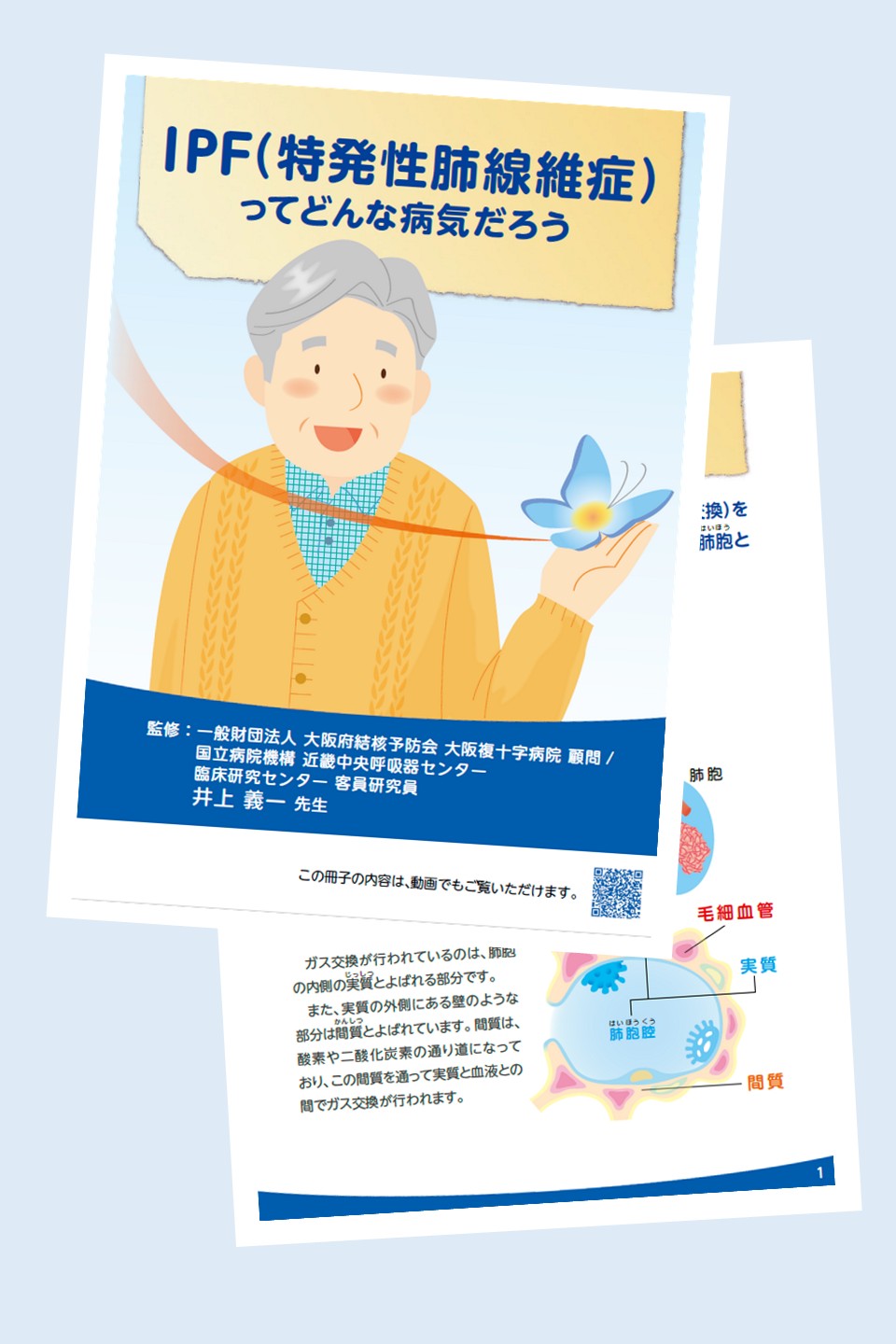 IPF（特発性肺線維症）ってどんな病気だろう