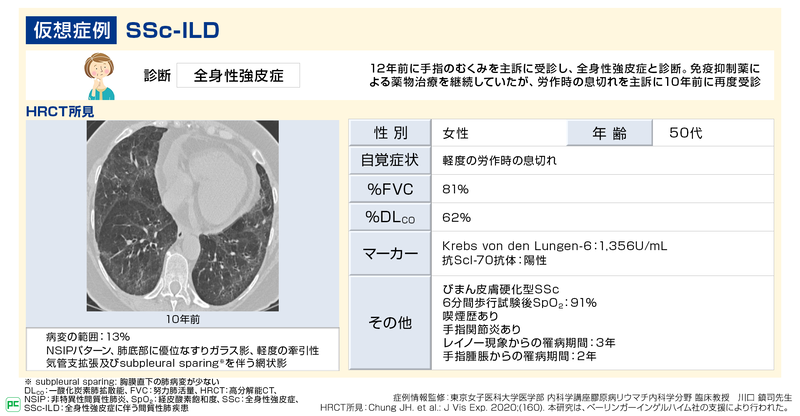 全身性強皮症に伴う間質性肺疾患(SSc-ILD)の診断と治療(静止画)01