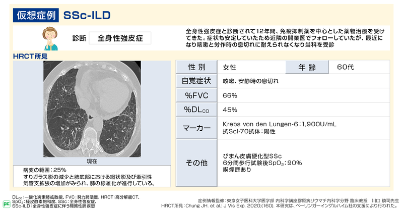 全身性強皮症に伴う間質性肺疾患(SSc-ILD)の診断と治療(静止画)02