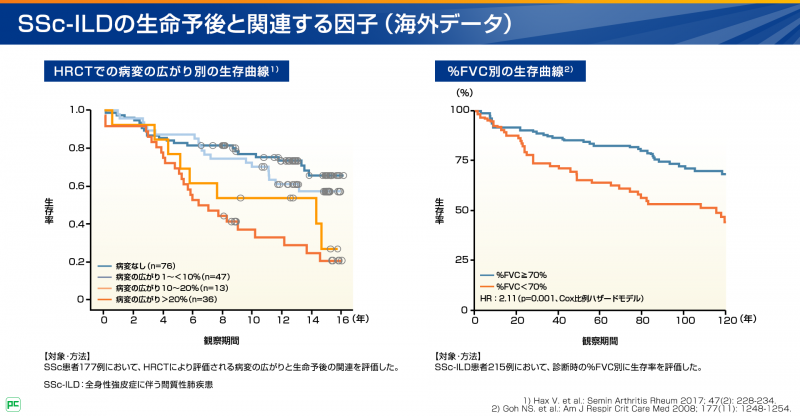 SSc-ILD診断の解説パート02
