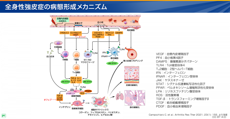 SSc-ILDの病態メカニズムとオフェブの作用機序01