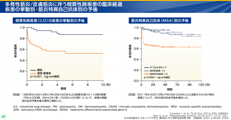 多発性筋炎/皮膚筋炎に伴う間質性肺疾患(PM/DM-ILD)患者さんの予後