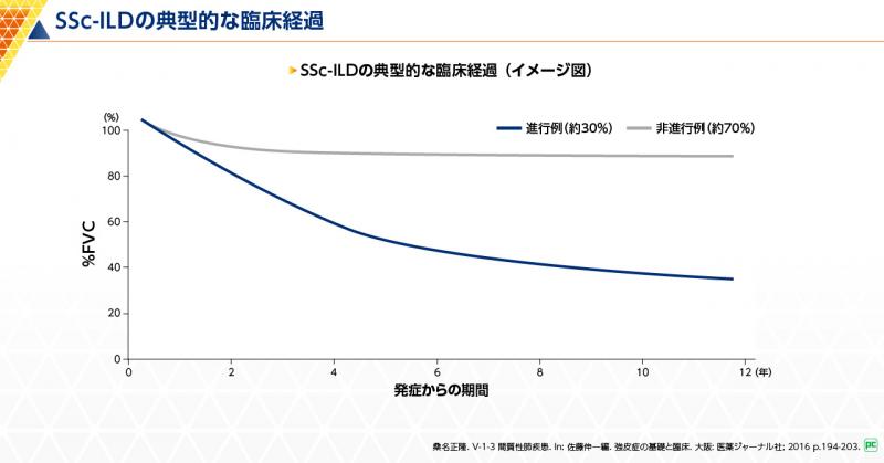 SSc-ILDの典型的な臨床経過 