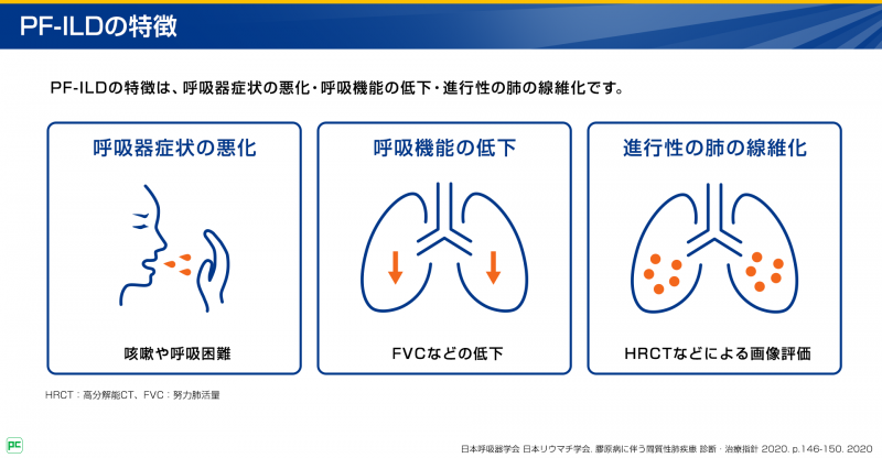 RA-ILDにおける進行性線維化の合併とモニタリング