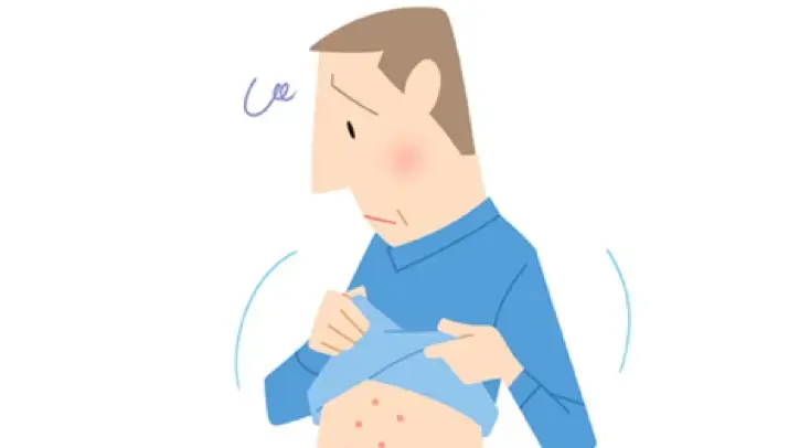 ジオトリフの副作用「皮膚障害」のマネジメント