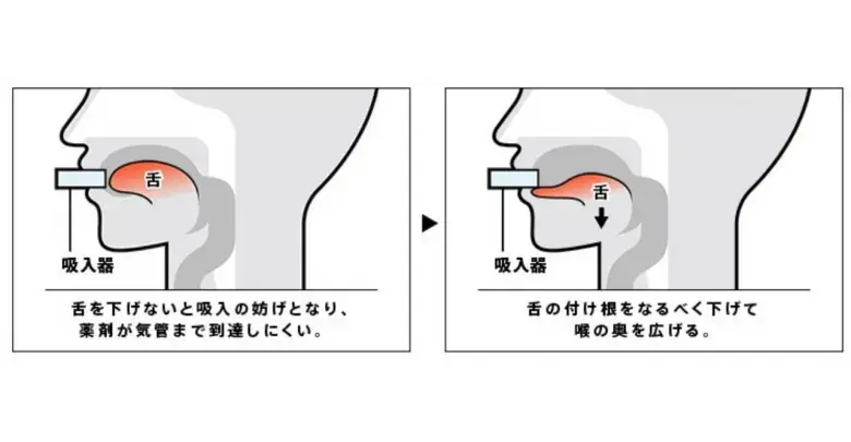 多職種連携によるチーム医療を目指して
