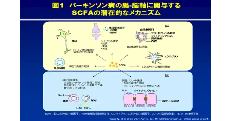 パーキンソン病における腸内細菌叢変化の役割：メカニズムの解明と治療法の選択肢