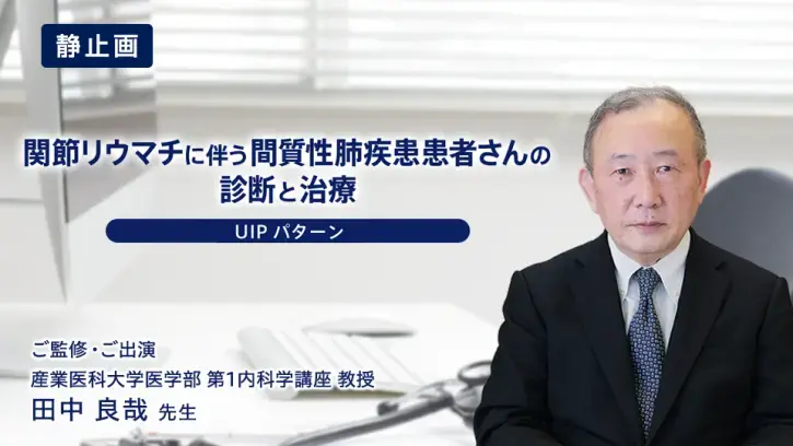 関節リウマチに伴う間質性肺疾患患者さんの診断と治療（UIPパターン）静止画