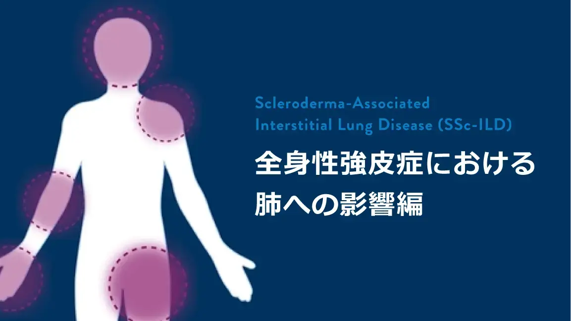 全身性強皮症における肺への影響編 (患者さん説明用)