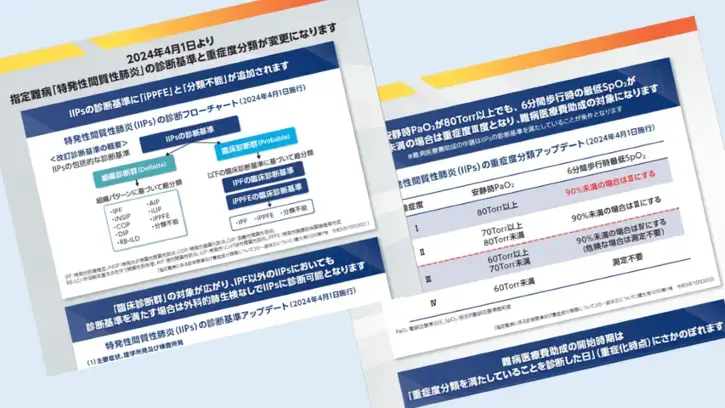 指定難病「特発性間質性肺炎」の診断基準と重症度分類の変更(2024年4月)