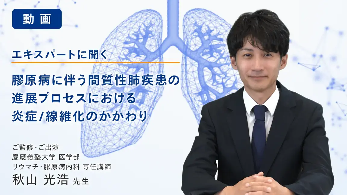 膠原病に伴う間質性肺疾患の進展プロセスにおける炎症/線維化のかかわり（動画）